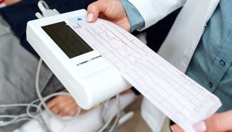 image of an ekg machine results